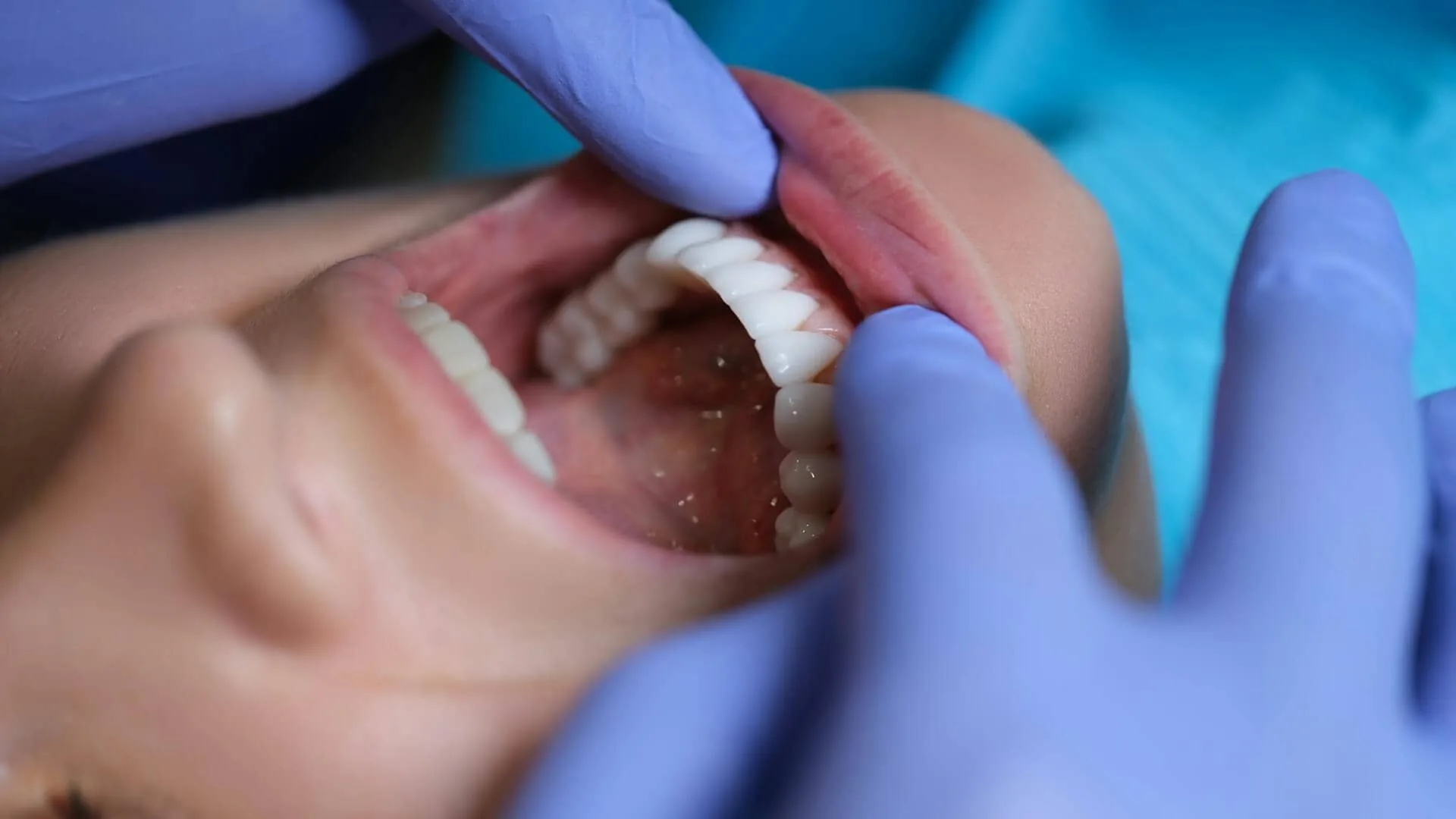 A person's open mouth