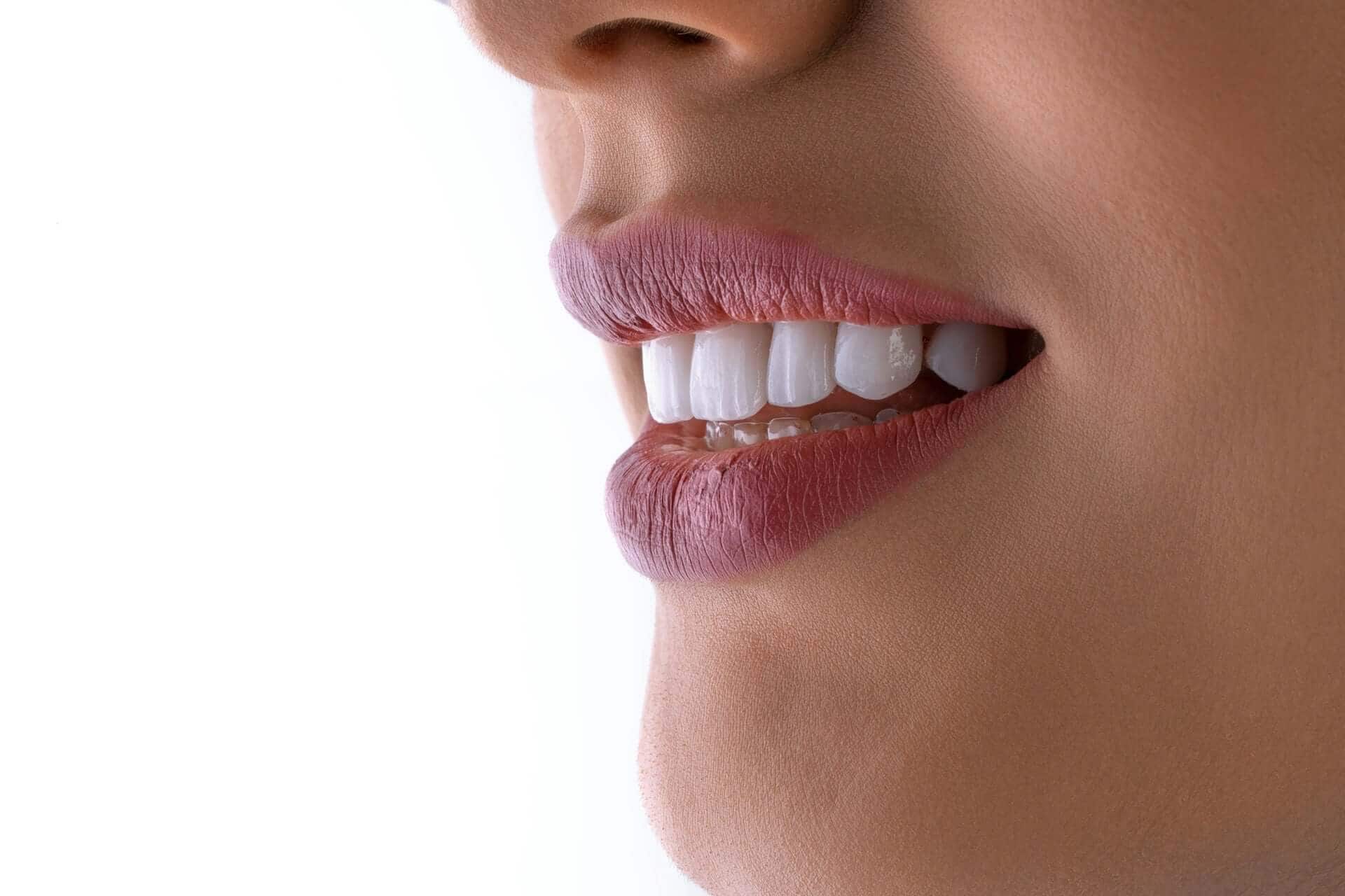 Dental Crowns