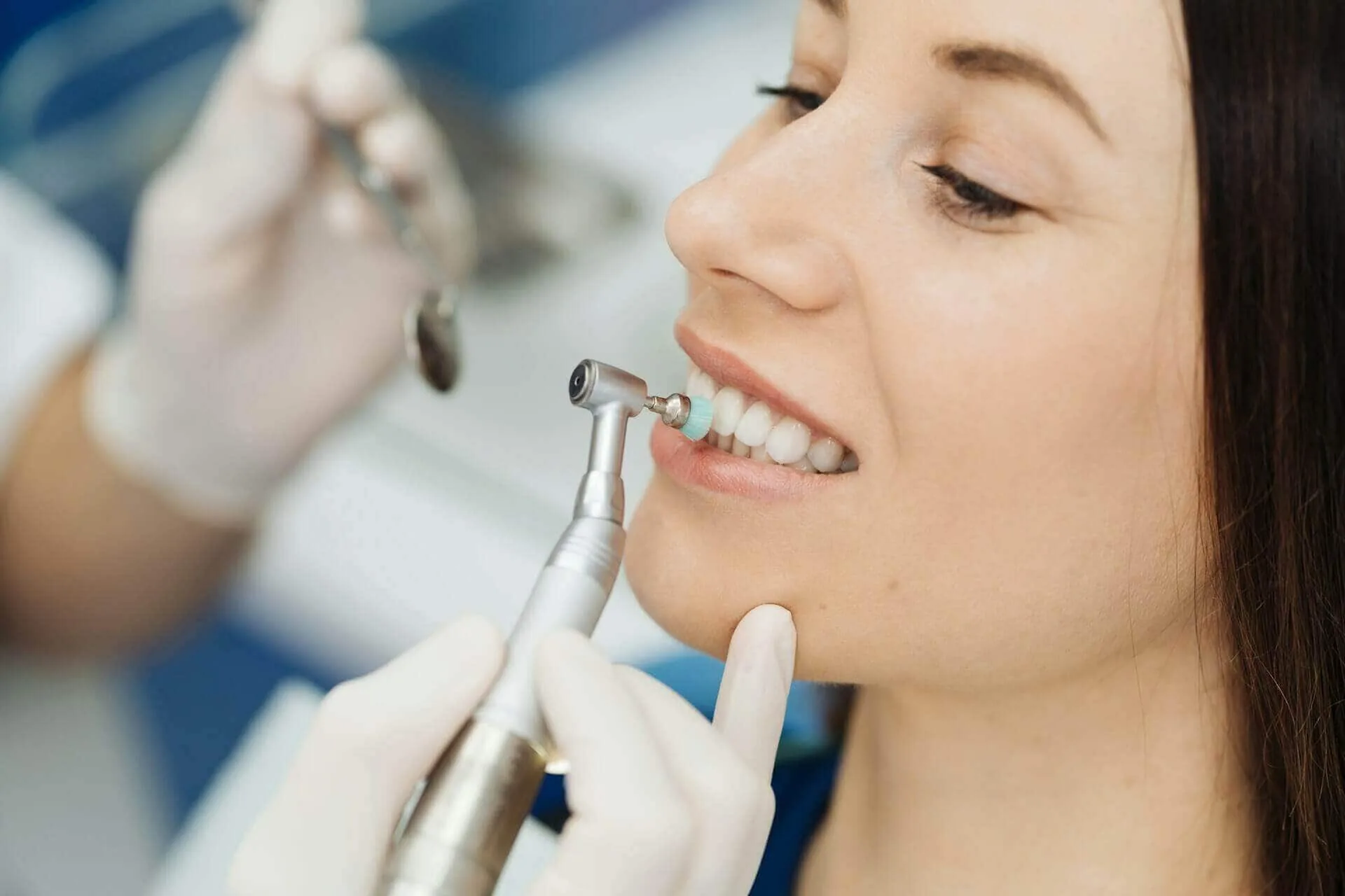 digital smile design veneers