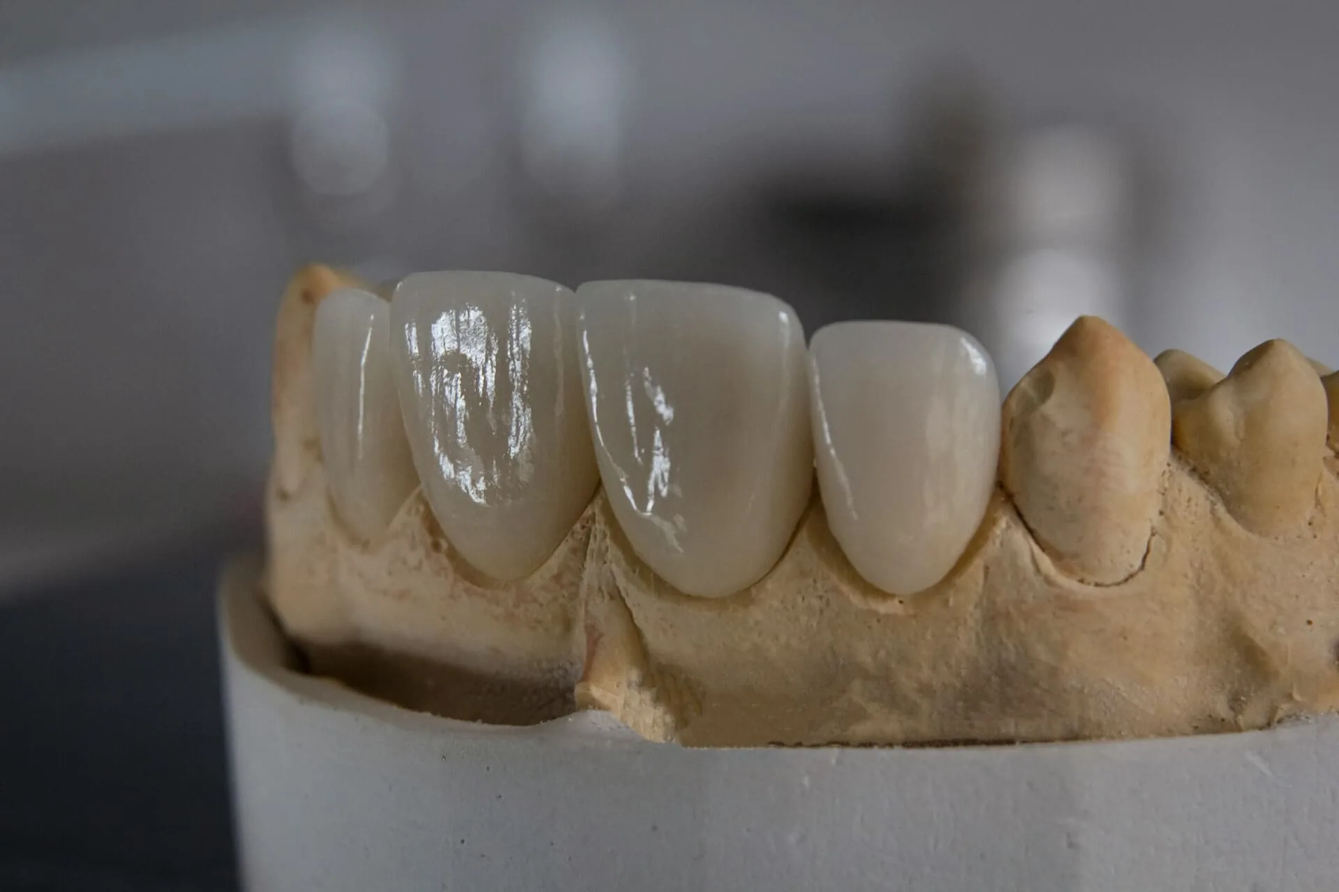 A visual presentation of a teeth