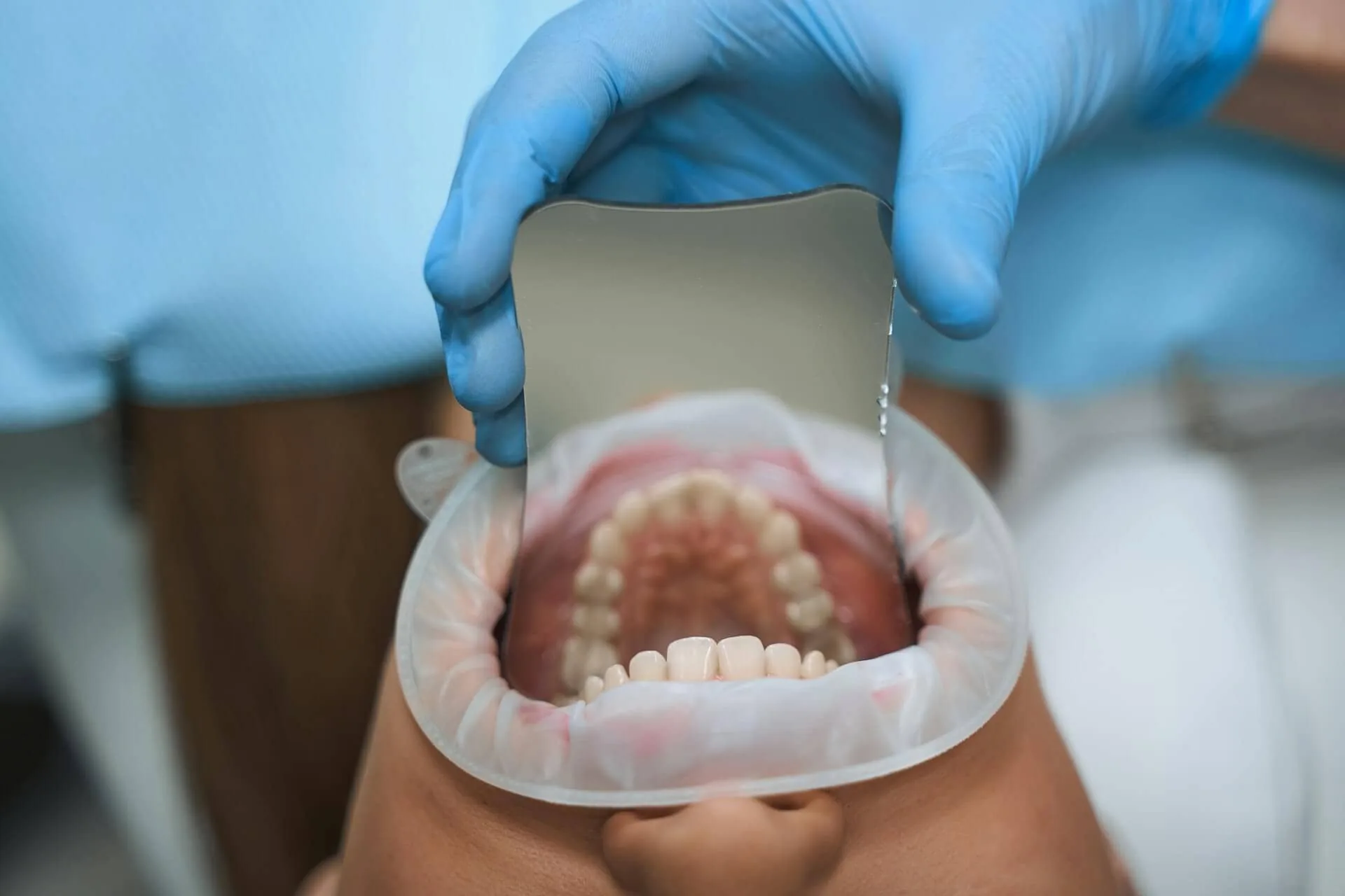 A photo of a mouth being inspected