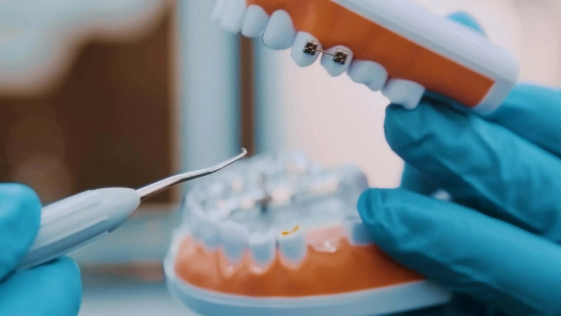 Metal Braces vs Clear Braces: Compare and Choose the Right Fit for You