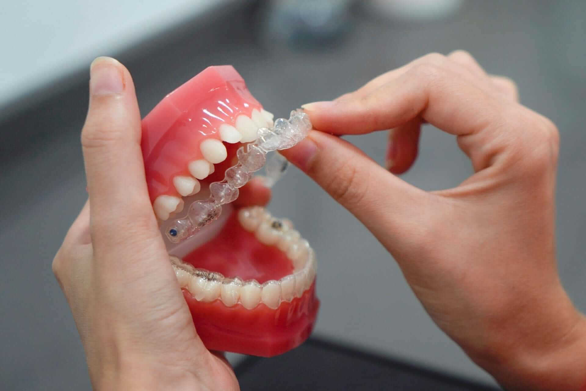 When Veneers May Help Reshape Teeth and Improve Your Smile