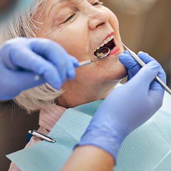 All-On-4 Dental Implant Dentist in Long Beach CA